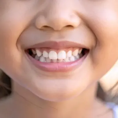 Pediatric dentistry for children